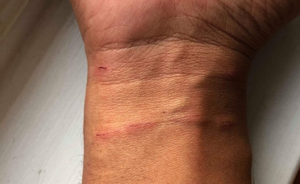 Man Billed $2,300 For Walking Into Emergency Room For Cat Scratch