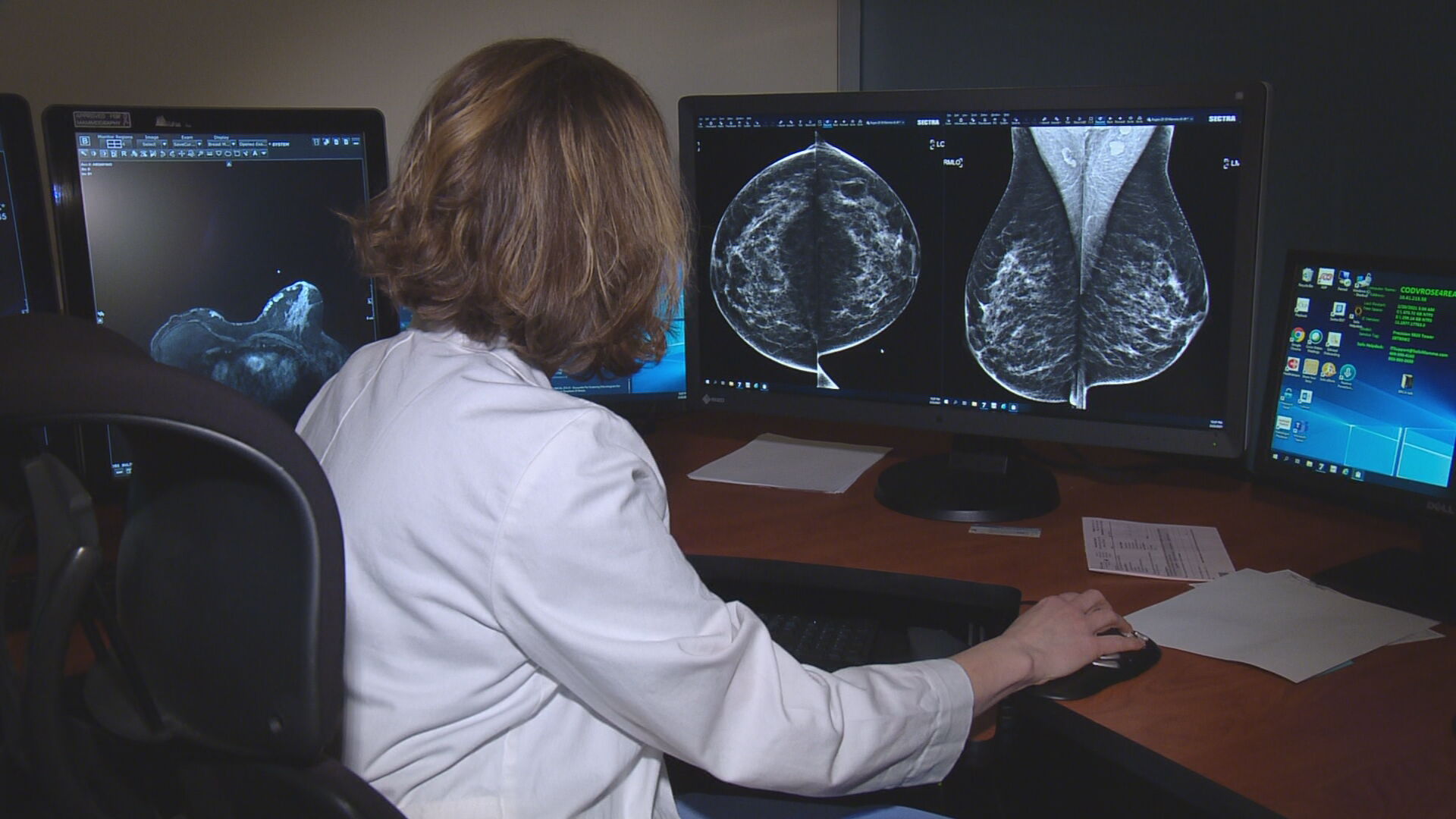 COVID In Colorado: Vaccines Can Cause Worrisome Side Effect For Women - CBS Denver