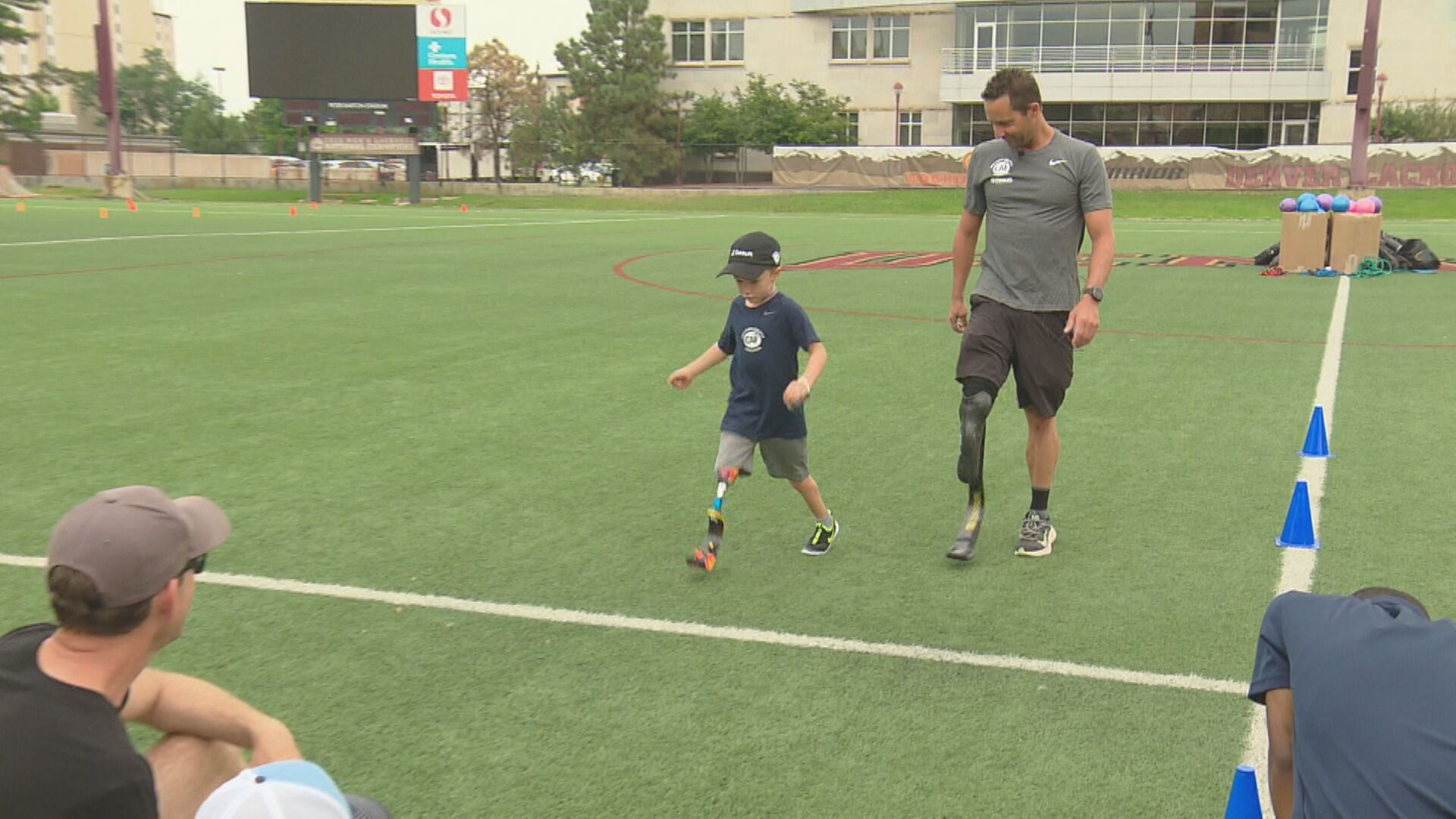 Boy given chance with new prosthetic leg